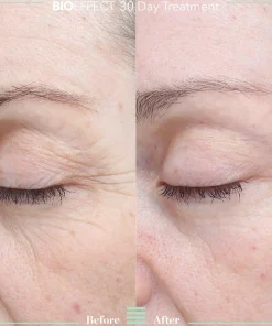 Bioeffect 30 day treatment tehohoito 3 kpl