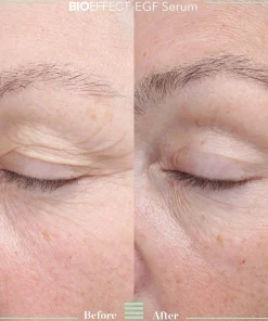 Bioeffect EGF Serum seerumi 15ml