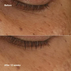 Clinique All About Eyes Brightening Serum Concentrate silmänympärysseerumi 10 ml