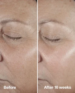 Clinique Smart Clinical Repair Seerumi 50 ml