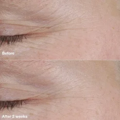 Clinique Smart Clinical Repair AM/PM Retinoid Balm täsmähoitotuote 3 g