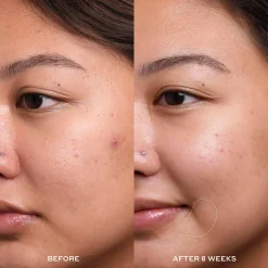 OleHenriksen Transform Dewtopia 20 % Acid Treatment yöseerumi 30 ml