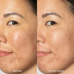 OleHenriksen Transform Glow2OH Dark Spot Toner kasvovesi 190 ml