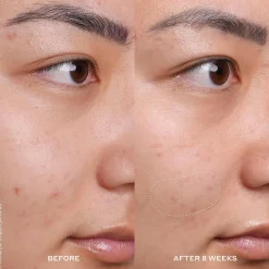 OleHenriksen Truth Banana Bright ™ Vitamin C seerumi 30 ml