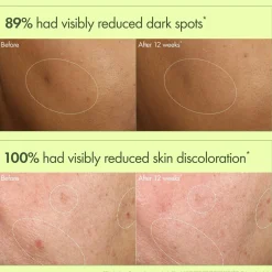 Origins Dr. Weil Mega-Mushroom Dark Spot Brightening Serum -seerumi 30 ml