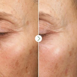 Pai Fade Forward Dark spot seerumi 30ml