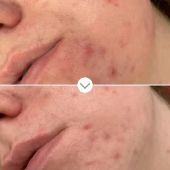 Pai Phaze Clarifying face wash puhdistustuote 100ml