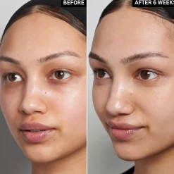 The Inkey List 15% Vitamin C ja EGF Serum 30 ml