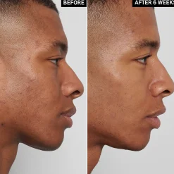 The Inkey List Mandelic Acid Treatment täsmähoito 15 ml