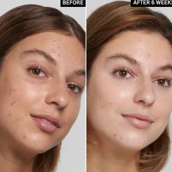 The Inkey List Salicylic Acid Cleanser puhdistusaine 150 ml