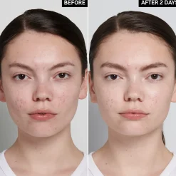 The Inkey List Succinic Acid Treatment hoitovoide 15 ml