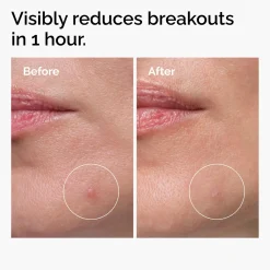 The Ordinary Sulfur 10% Powder-to-Cream Concentrate täsmätuote epäpuhtauksille 5g