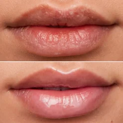 WONDERSKIN Lip Rehab Oil huultenhoitoöljy 3 ml